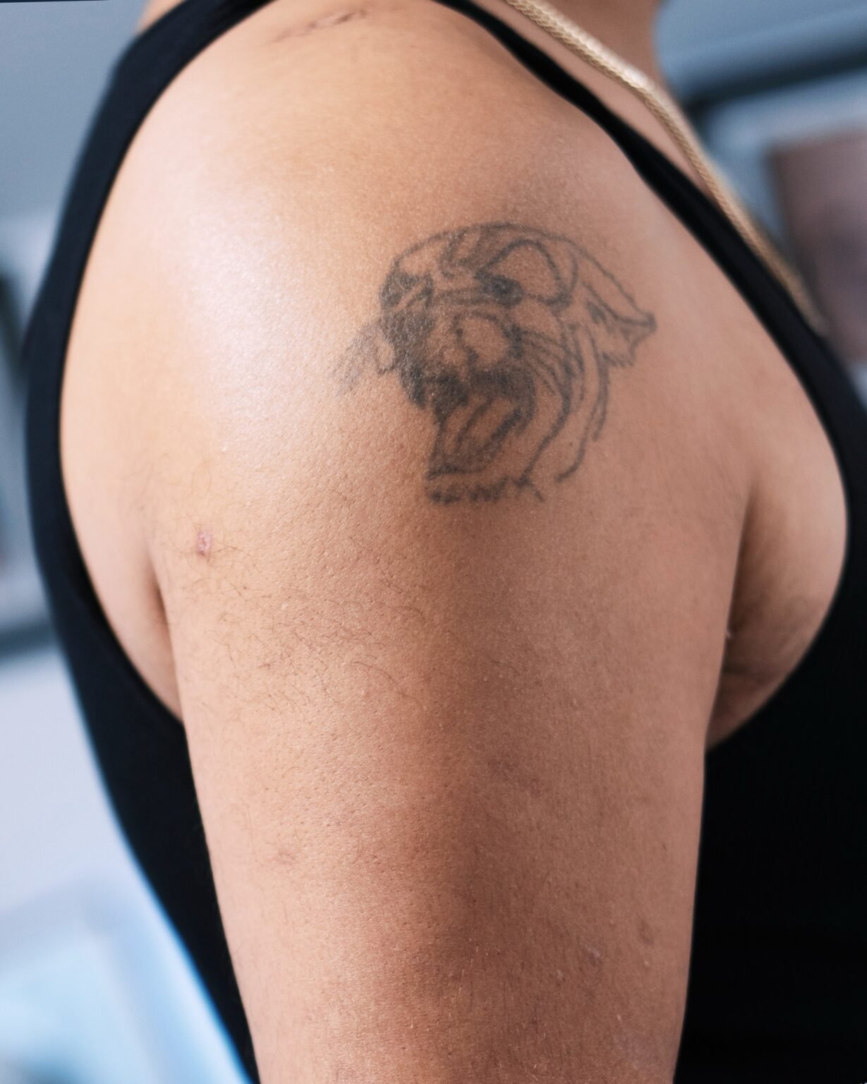 Faded grey panther head tattoo on the upper arm, before its cover-up at Tattoo Lab, Halifax